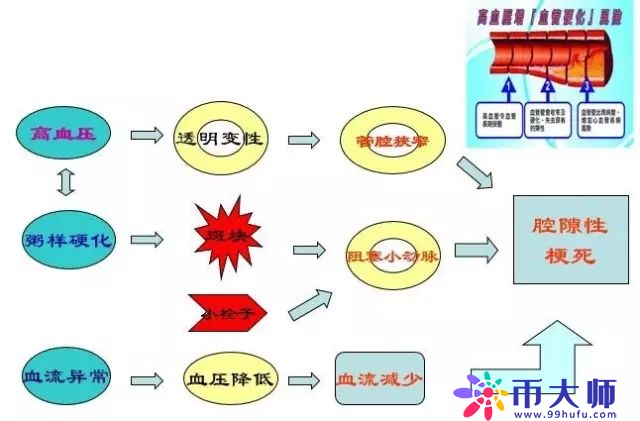 腔隙性脑梗死诊疗中的9大雷区，你踩过吗？